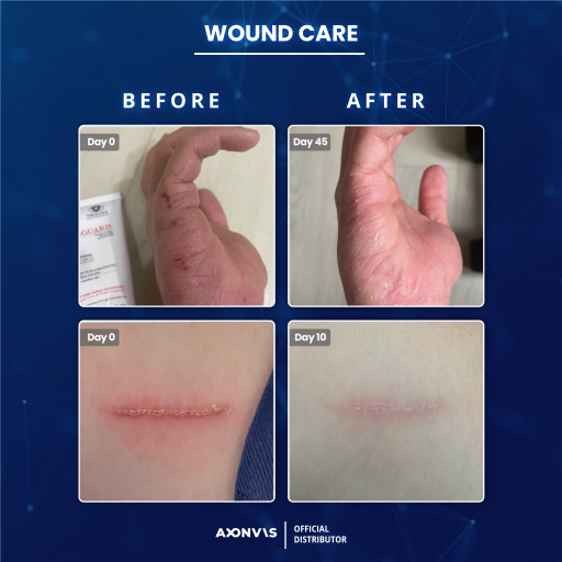 SkinGUARD Antimicrobial Moisturiser - image 7