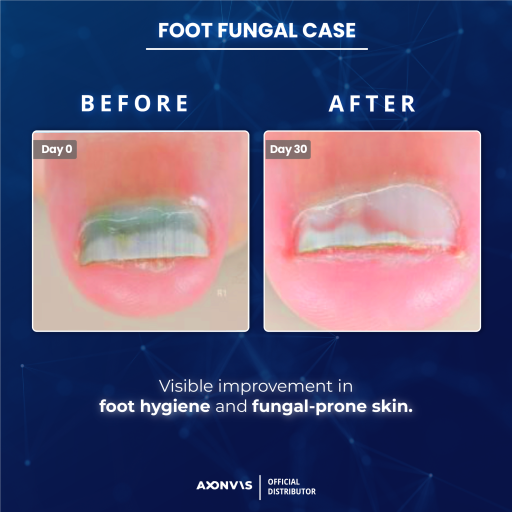 FOOTspray Antimicrobial Foot Spray - image 8