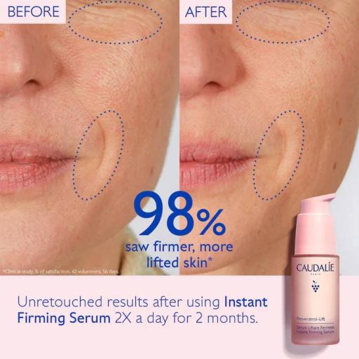 CAUDALIE Resveratrol-Lift Instant Firming Serum 10ml - image 3
