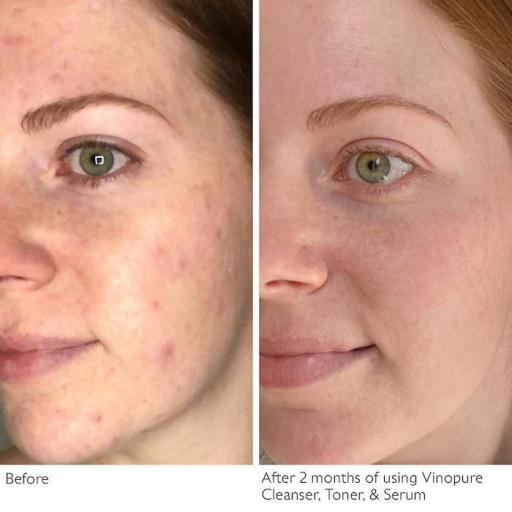 CAUDALIE Vinopure Skin Perfecting Serum 10ml - image 4
