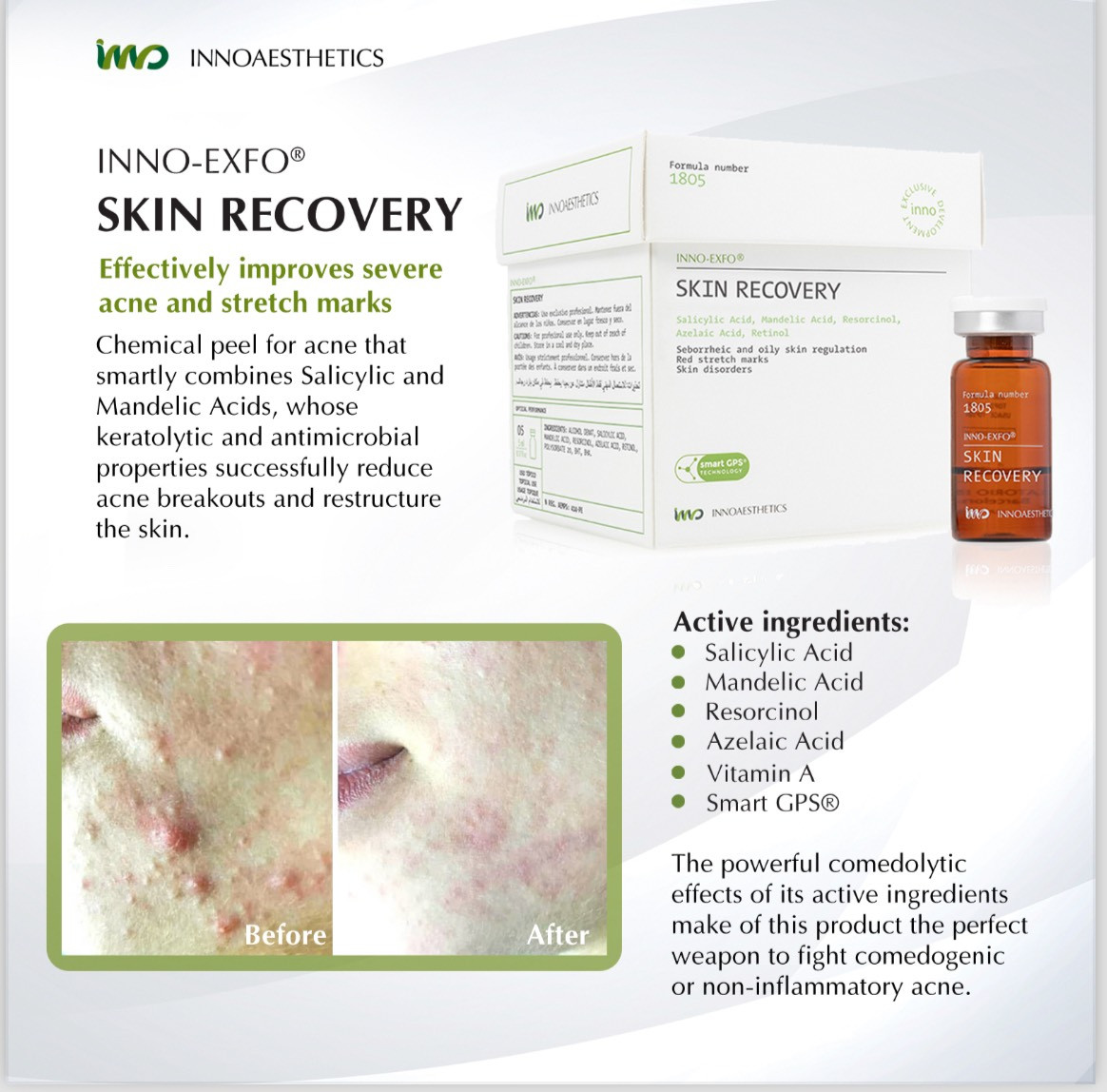 SKIN RECOVERY PEEL - TRIAL (SPAIN)