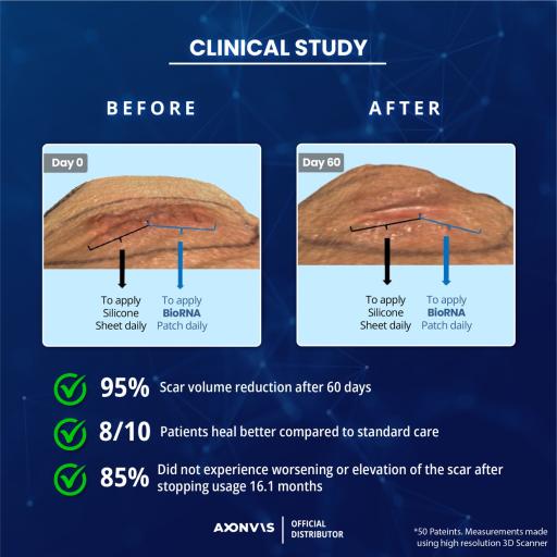 BioRNA Antiscar Patch - image 5